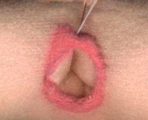 Mouth 3