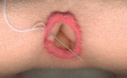 Mouth 5